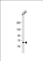 TEC Antibody in Western Blot (WB)