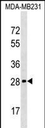 H1FOO Antibody in Western Blot (WB)