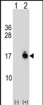 ACYP1 Antibody in Western Blot (WB)