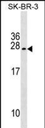 TUSC5 Antibody in Western Blot (WB)