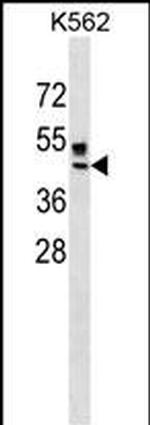 ZNRF4 Antibody in Western Blot (WB)