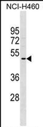 OR2A5 Antibody in Western Blot (WB)