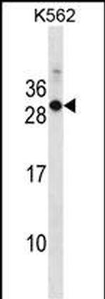 RAB17 Antibody in Western Blot (WB)