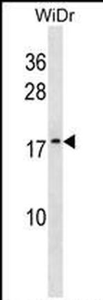 ATP5L2 Antibody in Western Blot (WB)