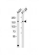 CTR9 Antibody in Western Blot (WB)