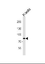 ANAPC2 Antibody in Western Blot (WB)