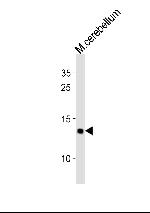 eIF1 Antibody in Western Blot (WB)