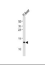 CXCL11 Antibody in Western Blot (WB)