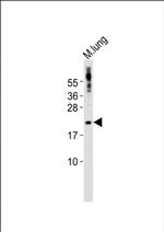 SCXA Antibody in Western Blot (WB)