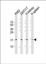 NFE4 Antibody in Western Blot (WB)