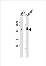 C17orf80 Antibody in Western Blot (WB)