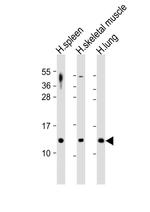 TARC Antibody in Western Blot (WB)