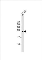 PUMA delta/gamma Antibody in Western Blot (WB)