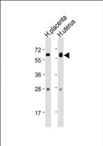 ZBTB7C Antibody in Western Blot (WB)