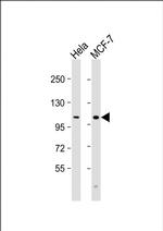 VLDLR Antibody in Western Blot (WB)