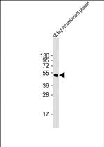 HSV Tag Antibody in Western Blot (WB)