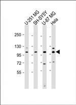 SH3PXD2B Antibody in Western Blot (WB)