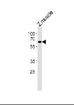 EDC3 Antibody in Western Blot (WB)