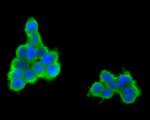 GABRB1 Antibody in Immunocytochemistry (ICC/IF)