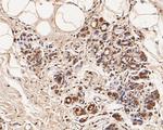 GABRB1 Antibody in Immunohistochemistry (Paraffin) (IHC (P))