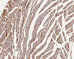 GABRB1 Antibody in Immunohistochemistry (Paraffin) (IHC (P))