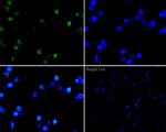 Histone H2A.X Antibody in Immunohistochemistry (Paraffin) (IHC (P))