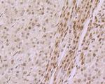 Histone H2A.X Antibody in Immunohistochemistry (Paraffin) (IHC (P))