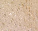 Fascin Antibody in Immunohistochemistry (Paraffin) (IHC (P))