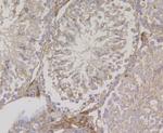 Fascin Antibody in Immunohistochemistry (Paraffin) (IHC (P))