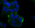 Cytokeratin 20 Antibody in Immunocytochemistry (ICC/IF)