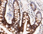 Cytokeratin 20 Antibody in Immunohistochemistry (Paraffin) (IHC (P))