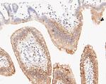 Cytokeratin 20 Antibody in Immunohistochemistry (Paraffin) (IHC (P))