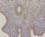 TRADD Antibody in Immunohistochemistry (Paraffin) (IHC (P))