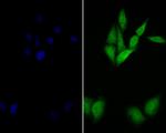 delta Catenin Antibody in Immunocytochemistry (ICC/IF)