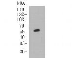 Cytokeratin 5/6 Antibody in Western Blot (WB)