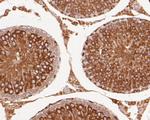 delta Catenin Antibody in Immunohistochemistry (Paraffin) (IHC (P))