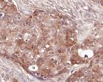 delta Catenin Antibody in Immunohistochemistry (Paraffin) (IHC (P))