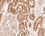 delta Catenin Antibody in Immunohistochemistry (Paraffin) (IHC (P))