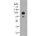 delta Catenin Antibody in Western Blot (WB)