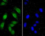 ITCH Antibody in Immunocytochemistry (ICC/IF)