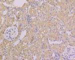 Folate Receptor alpha Antibody in Immunohistochemistry (Paraffin) (IHC (P))