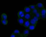 DPP6 Antibody in Immunocytochemistry (ICC/IF)