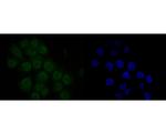 MDM2 Antibody in Immunocytochemistry (ICC/IF)