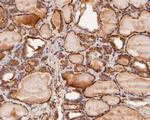 MDM2 Antibody in Immunohistochemistry (Paraffin) (IHC (P))