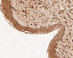 MDM2 Antibody in Immunohistochemistry (Paraffin) (IHC (P))