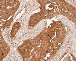 MDM2 Antibody in Immunohistochemistry (Paraffin) (IHC (P))