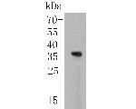 KCNIP1 Antibody in Western Blot (WB)