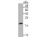 Cardiac Troponin C Antibody in Western Blot (WB)