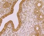 TGM2 Antibody in Immunohistochemistry (Paraffin) (IHC (P))