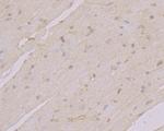 TGM2 Antibody in Immunohistochemistry (Paraffin) (IHC (P))